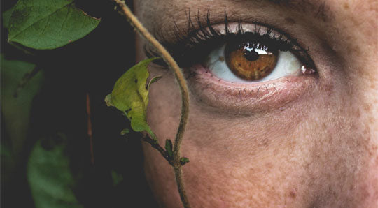 What is Hyperpigmentation?  9 Causes & The Best Natural Products to Help